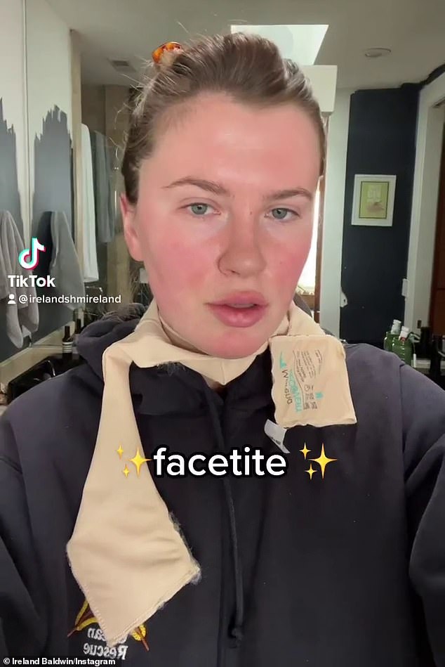 Jujur: Irlandia Baldwin berbicara tentang mengapa dia menjalani FaceTite, prosedur kosmetik invasif minimal yang sebanding dengan facelift bedah, bulan ini