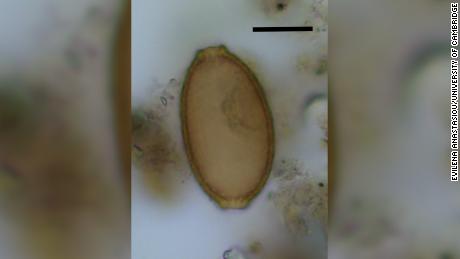 Kotoran manusia purba mengandung telur cacing rambut mikroskopis, yang diidentifikasi sebagian oleh bentuk lemon. 